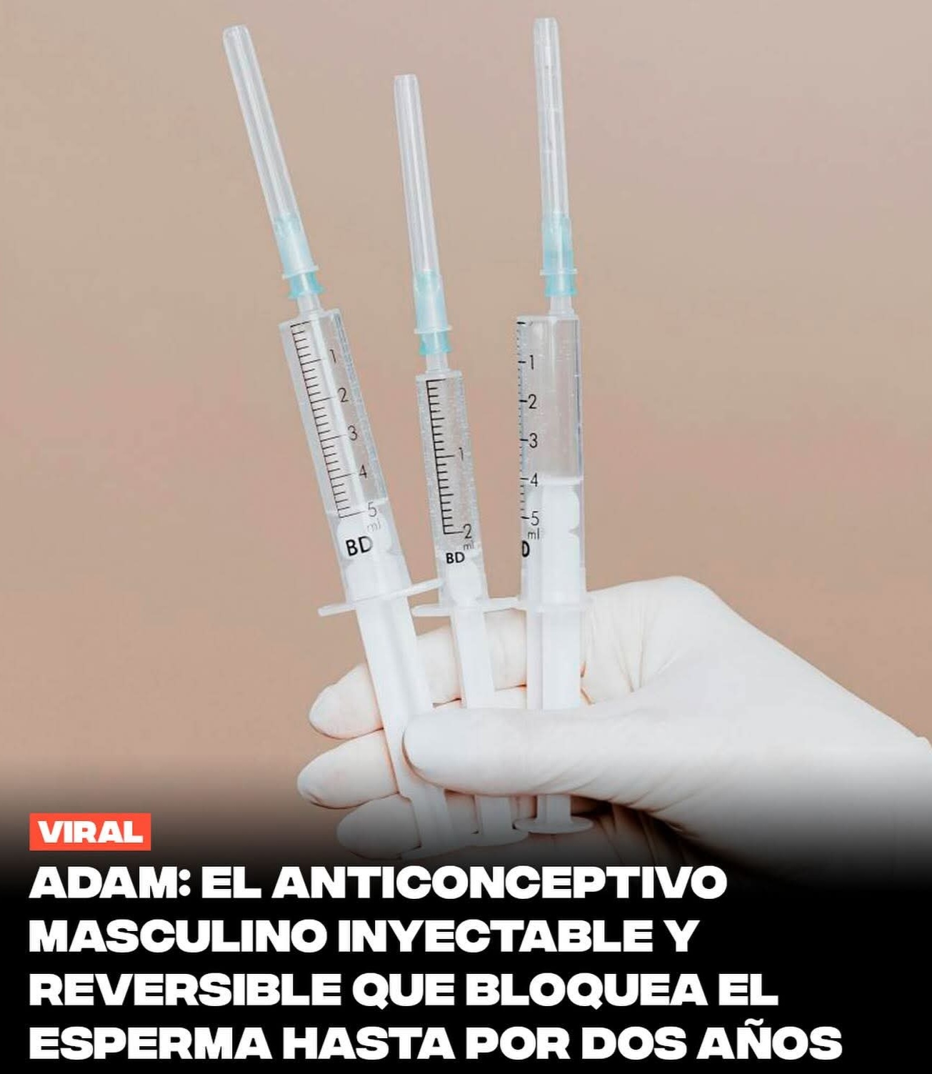 ADAM es un nuevo método anticonceptivo en desarrollo que consiste en la inyección de un hidrogel en los conductos deferentes, los canales que transportan el esperma. El gel bloquea físicamente el paso de los espermatozoides durante la eyaculación.